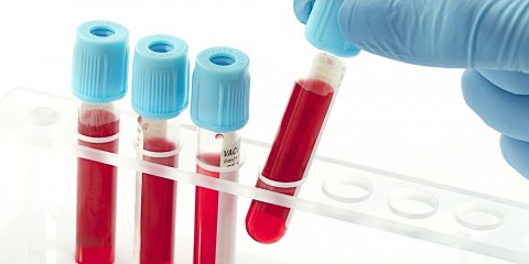 The Importance of Functional Blood Chemistry